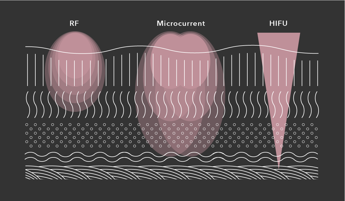 Microcurrent A Workout for Your Face